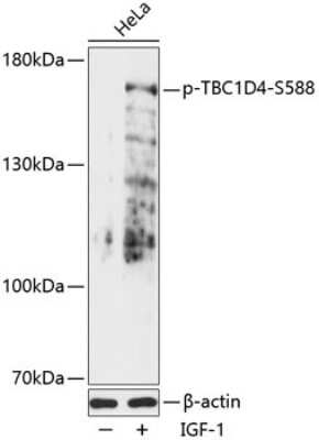 Western Blot: TBC1D4 [p Ser588] AntibodyAzide and BSA Free [NBP3-05451]